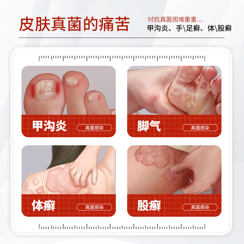 [亮甲]硝酸咪康唑溶液 2%*20ml 1盒装 20ml