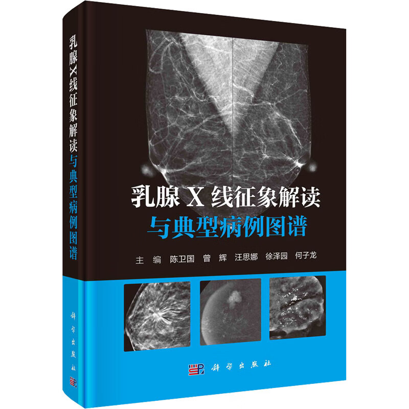 乳腺X线征象解读与典型病例图谱 图书