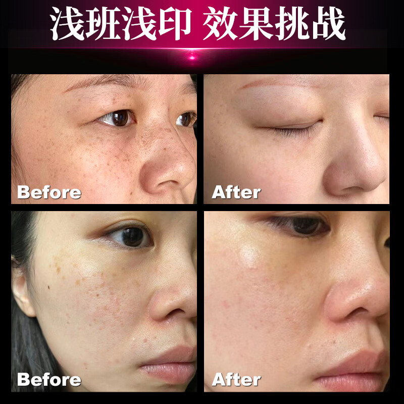 小野拓司2代升级我要铂面膜 15分钟闪白 超越水光biu 提亮减黄K衰修护 1盒·上新体验:288元/盒 立省250元