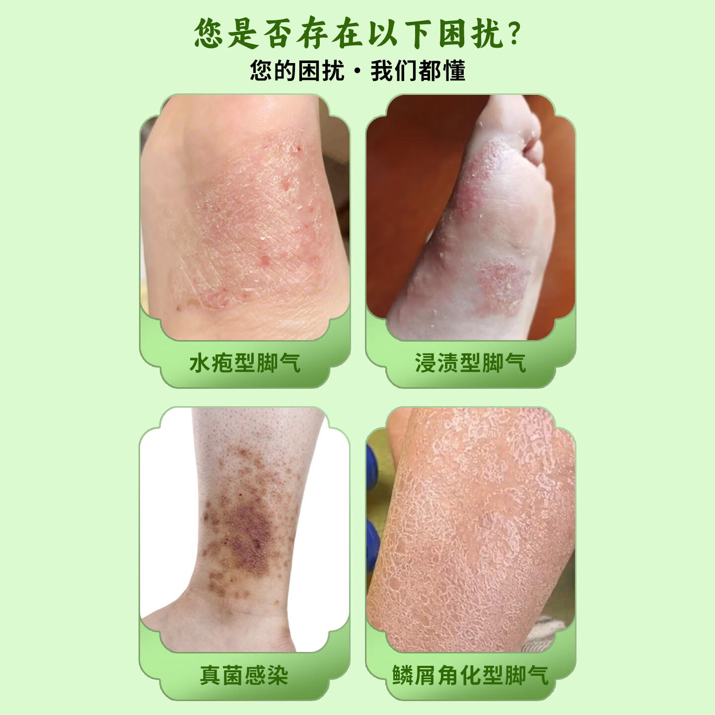 富晴脚气止痒灵脚后跟干裂修复霜防裂足脱皮强效滋润门店同款