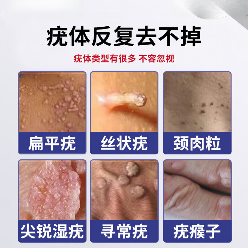 鹤古安尤肤平保健液干扰素凝胶去疣药丝状疣一抹灵扁平疣去除喷剂 3瓶【周期改善装疣疾无忧】买二赠一 【官方直售】