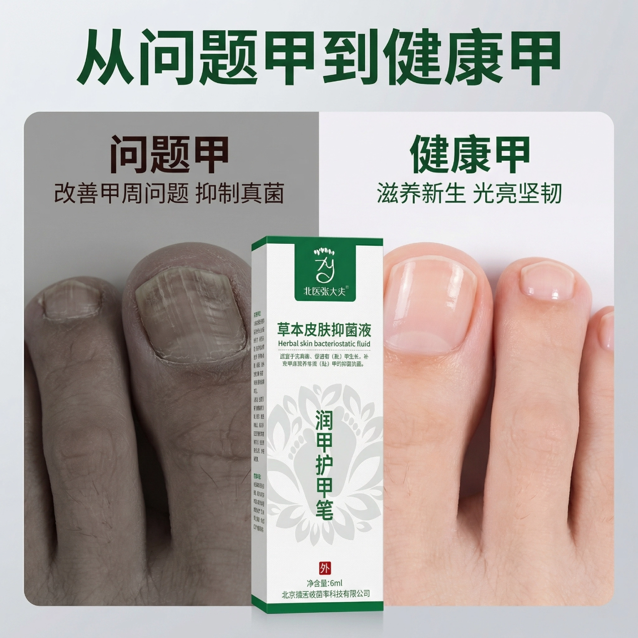 医步北医张大夫草本抑菌乳膏止痒专用 润甲笔生甲用