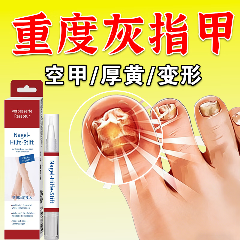 L0【德国进口】灰指甲笔抑菌液去灰指甲甲增厚专用修复指甲护理正品 【重度疗程】灰指甲笔*3.