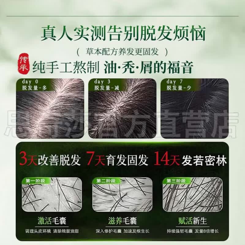 北柔(BEIROU)众康尚品头发滋养液七天防脱去屑止痒浓密增长强韧发丝官方正品 1瓶装【体验发正装】 【官方直售 京质保障】