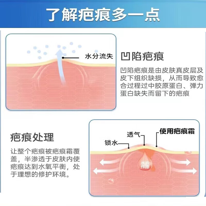 修正水痘疤痕修复凝胶水痘坑痘印复凹洞搭配生长因子祛陷疤膏儿童成人 单盒【体验装】