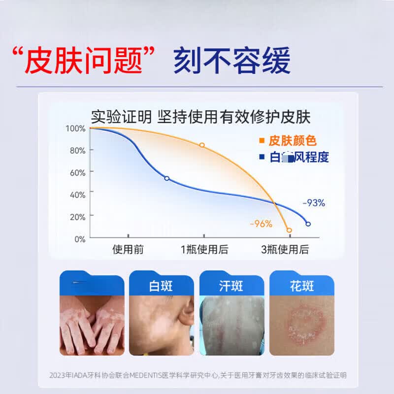 BEIYVS库西严复色素去白斑膏白癜风专用膏黑色素生长补骨脂酊专用 1盒装【试用装】多盒更实惠 【官方旗舰 京质保障】