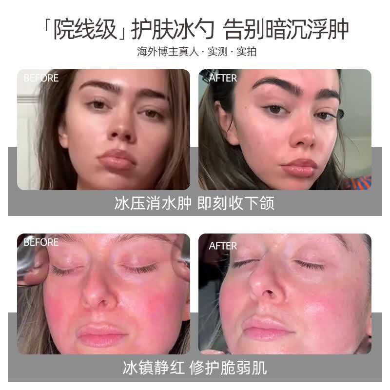 PFEFE珀法瑞美容院推荐面部美容仪冰敷按摩眼部提拉脸部肌肤冰锤冷敷仪 PFEFE009白色冰勺