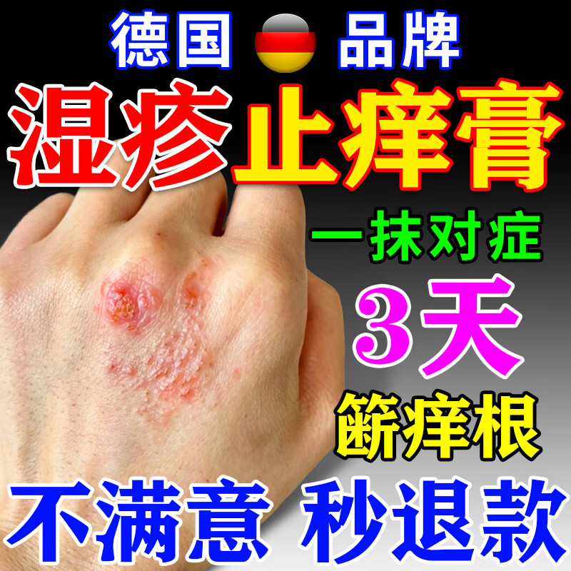 湿疹药膏十大牌子止痒抑菌皮肤瘙痒去顽固湿毒皮炎皮癣湿疹止痒膏 【德国研发】1盒 皮肤用药干裂起皮湿疹瘙痒止痒膏