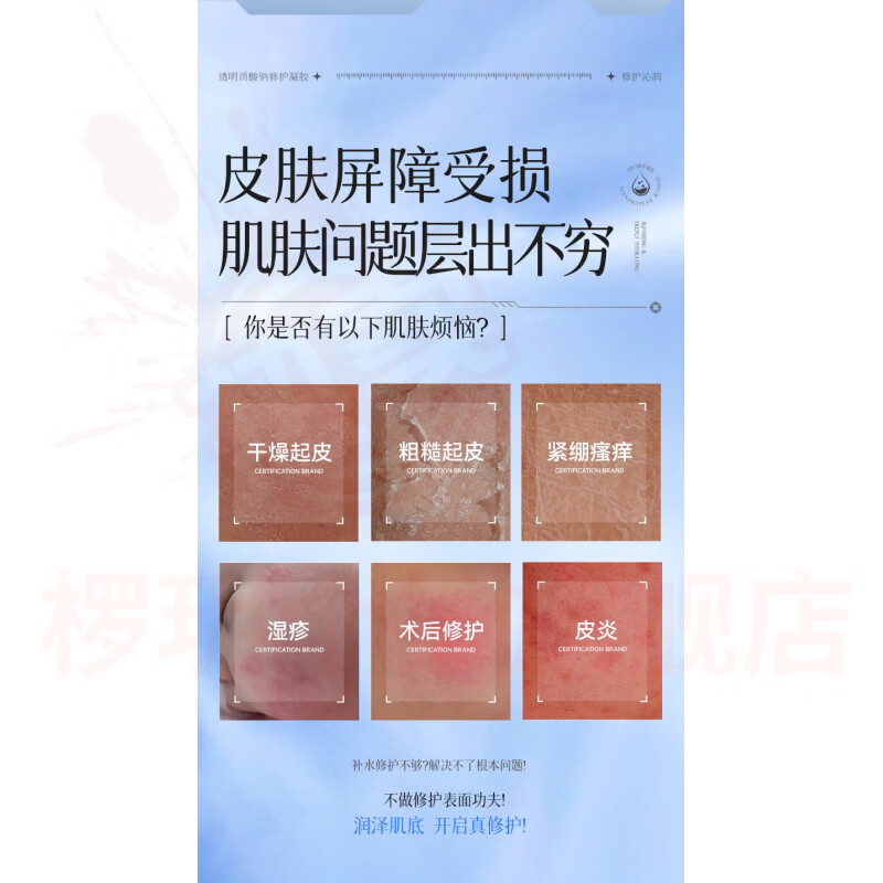 熏姿颜奥传司修复凝胶修复皮肤过敏轻中度痤疮促进创面愈合男女适用 5支【巩固装】 官方自售