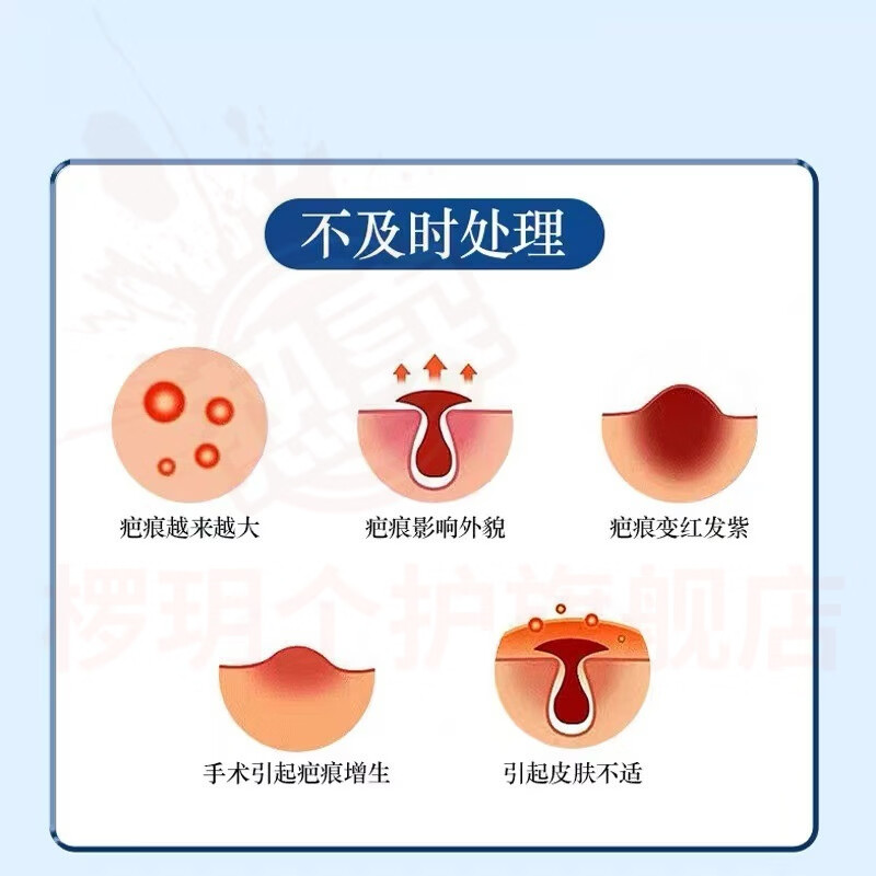 熏姿颜贝士鑫医用疤痕硅酮凝胶修复术后烧烫伤生长纹妊娠纹增生官方正品 5盒周期装【针对严重疤痕】 官方自售