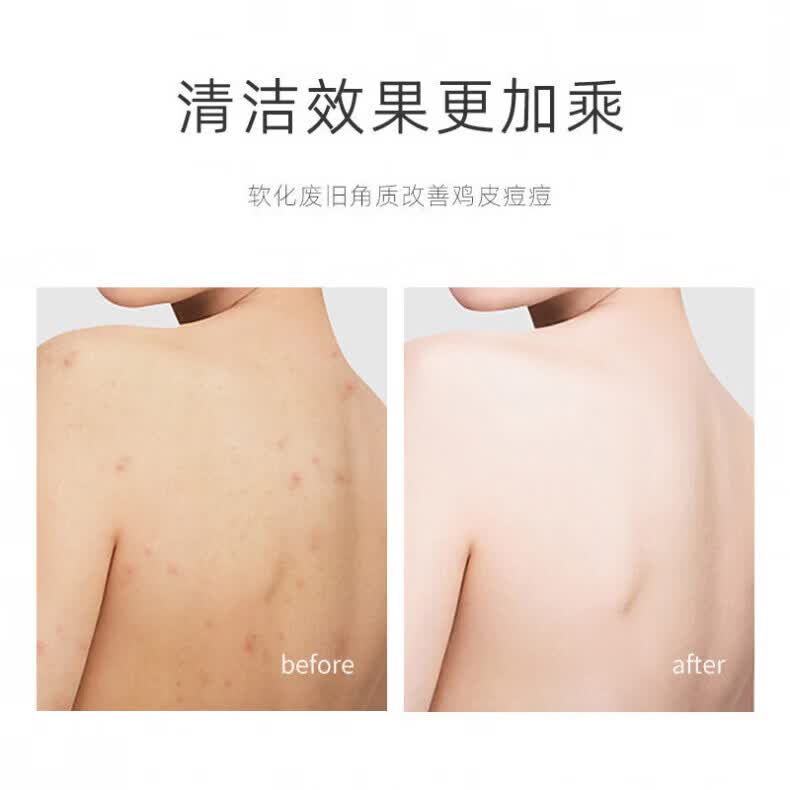 AILUKI日本浴盐洗澡专用消炎杀菌止痒搓澡盐除螨磨砂角质全身清洁 一支装【体验装】