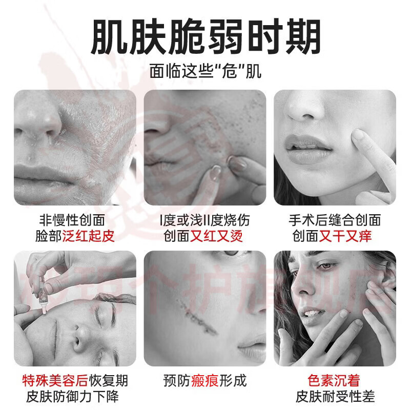 熏姿颜kga蛋白膜祛法令纹颈纹收缩细腻毛孔淡化痘印痘坑紧致抗皱修复乳 5支【巩固装】 官方自售