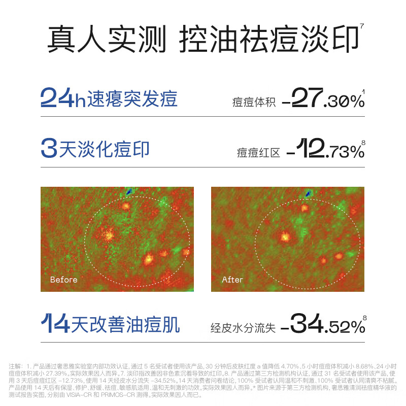 奢思雅清润祛痘精华液2.0点痘笔控油祛痘敏肌改善粉刺温和 1盒装6支