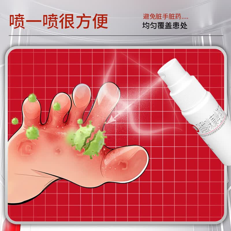 [亮甲]硝酸咪康唑溶液 2%*20ml 1盒装 20ml