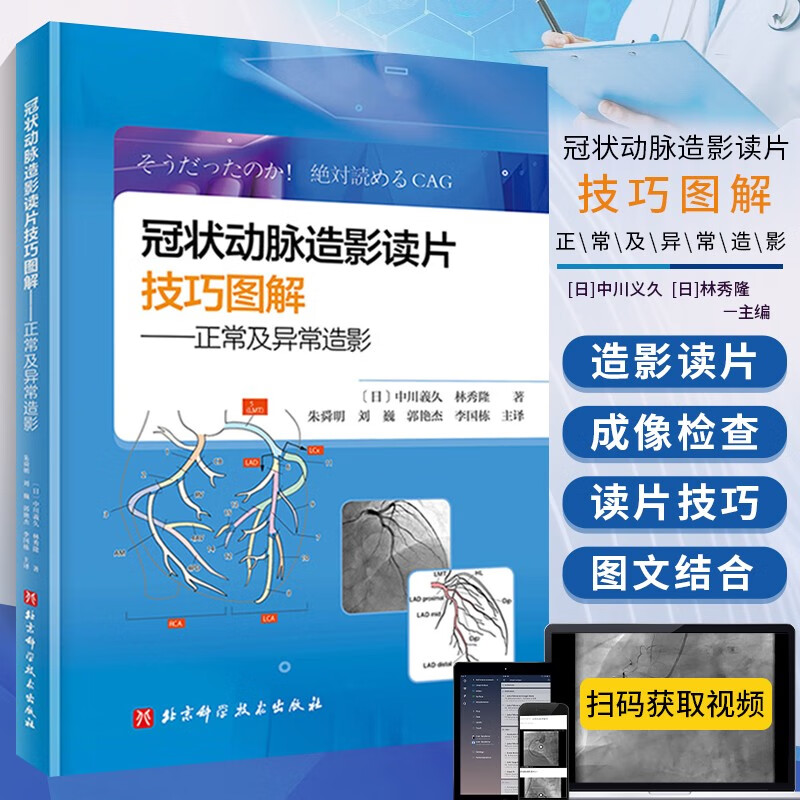 图解冠状动脉造影读片图解快速进阶pci达人 冠脉结构临床解读 心血管