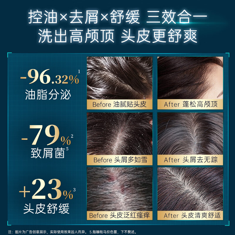 卡蓓诺（CABELO）控油去屑舒缓头皮洗发水350ml头油头痒头屑适用【日本原装进口】 卡蓓诺 去屑止痒洗发水 350ml*1