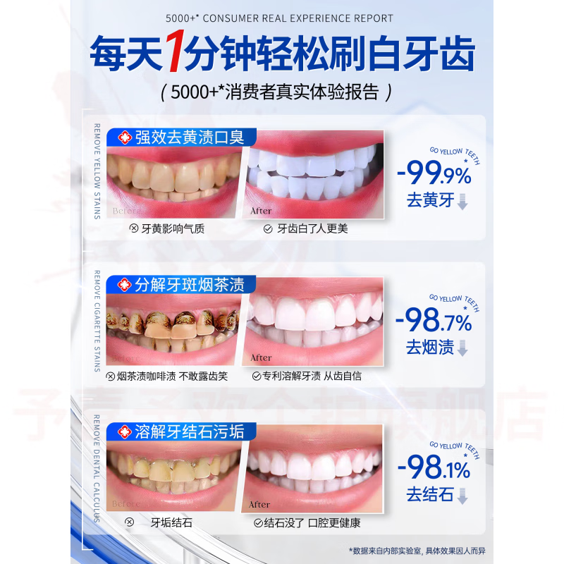 鹿角卉映氧清新美白牙膏去黄口臭牙垢牙石牙菌色修美白口气清新去异味 五支装 【全家呵护】 官方自售