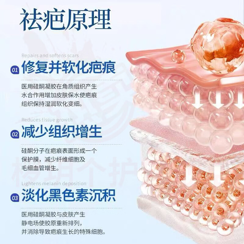 熏姿颜贝士鑫医用疤痕硅酮凝胶修复术后烧烫伤生长纹妊娠纹增生官方正品 5盒周期装【针对严重疤痕】 官方自售