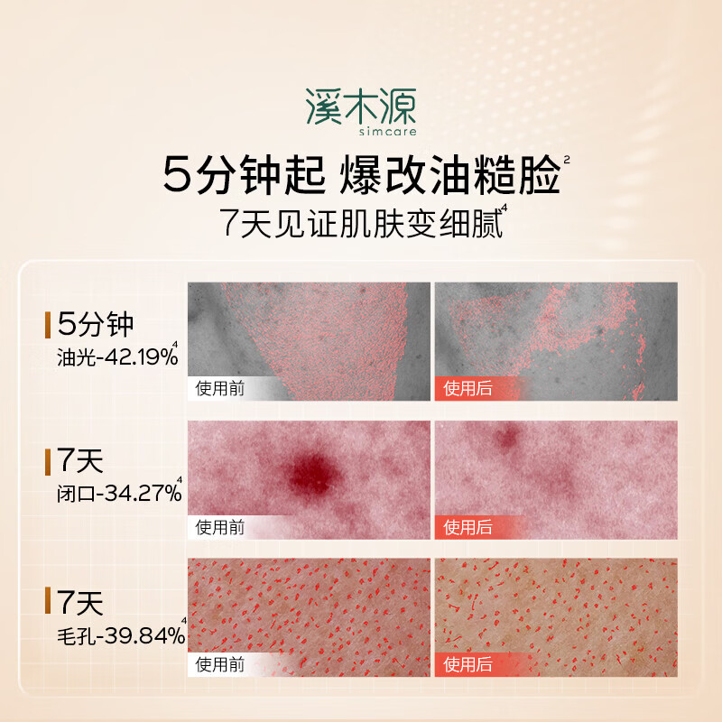 溪木源水乳套装层孔菌油皮夏季控油提亮舒缓泛红细腻毛孔男女通用护肤品 层孔菌精华水120ml