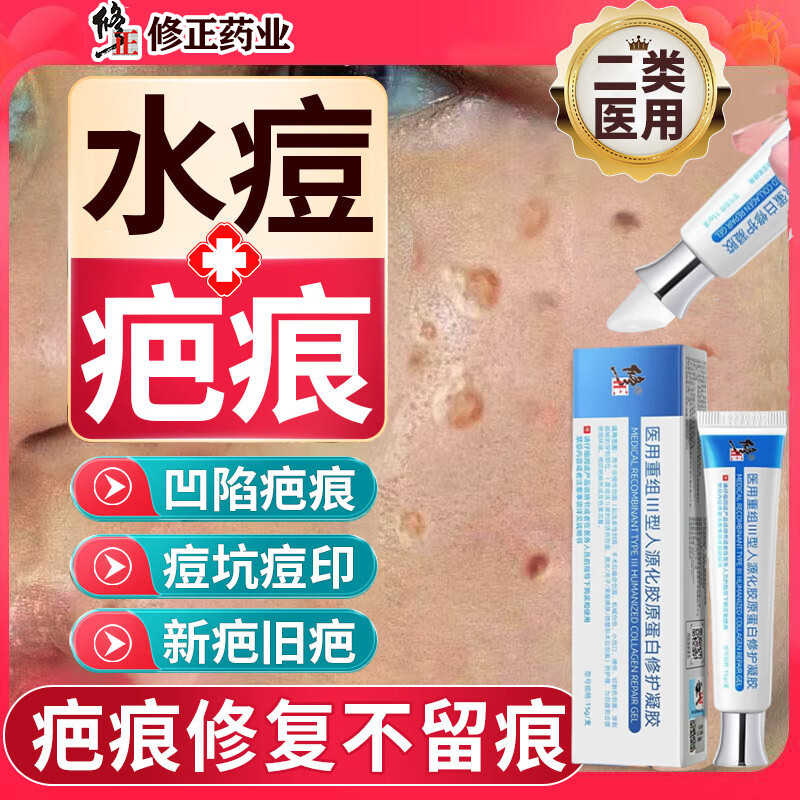 修正水痘疤痕修复凝胶水痘坑痘印复凹洞搭配生长因子祛陷疤膏儿童成人 单盒【体验装】