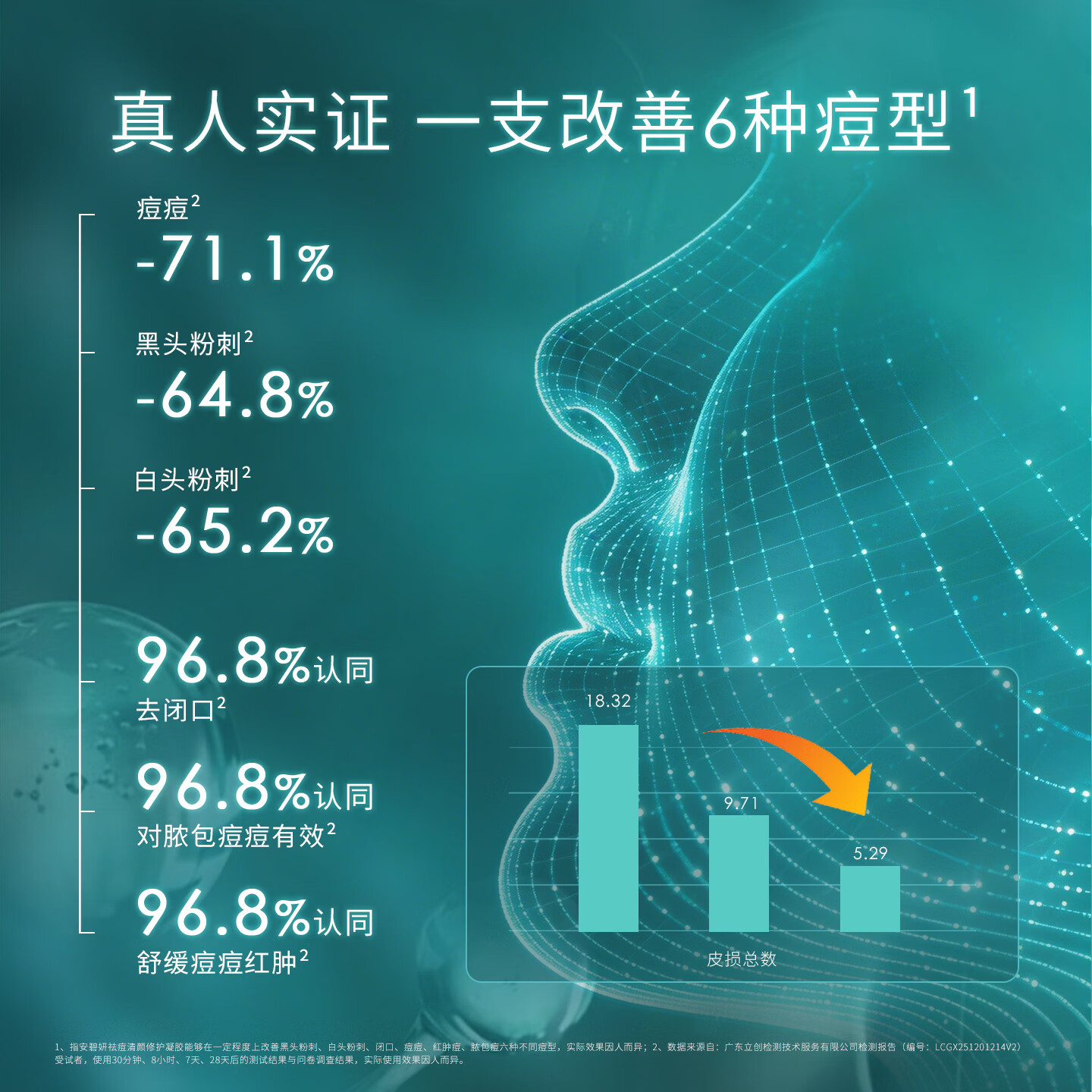 安碧妍华西专利成果转化祛痘凝胶10g