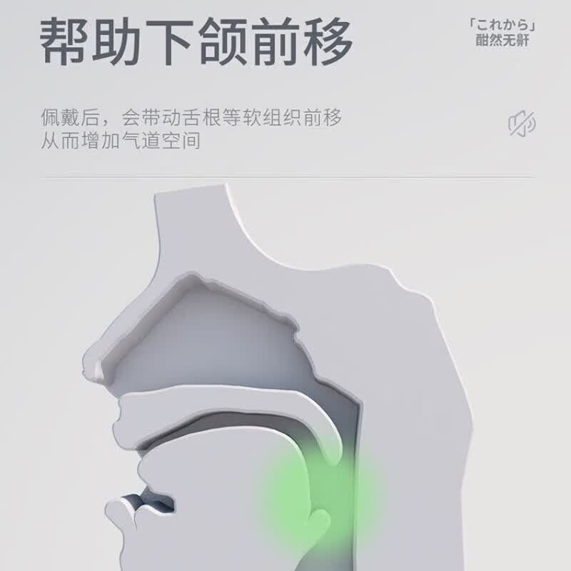 HYEGIIR止鼾牙套睡觉防张嘴打呼噜医用级纠正磨牙咬嘴唇口腔矫正硅胶 止鼾牙套