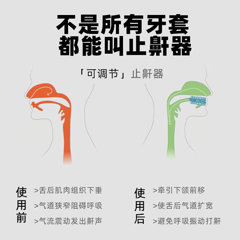 HYEGIIR止鼾牙套睡觉防张嘴打呼噜医用级纠正磨牙咬嘴唇口腔矫正硅胶 止鼾牙套