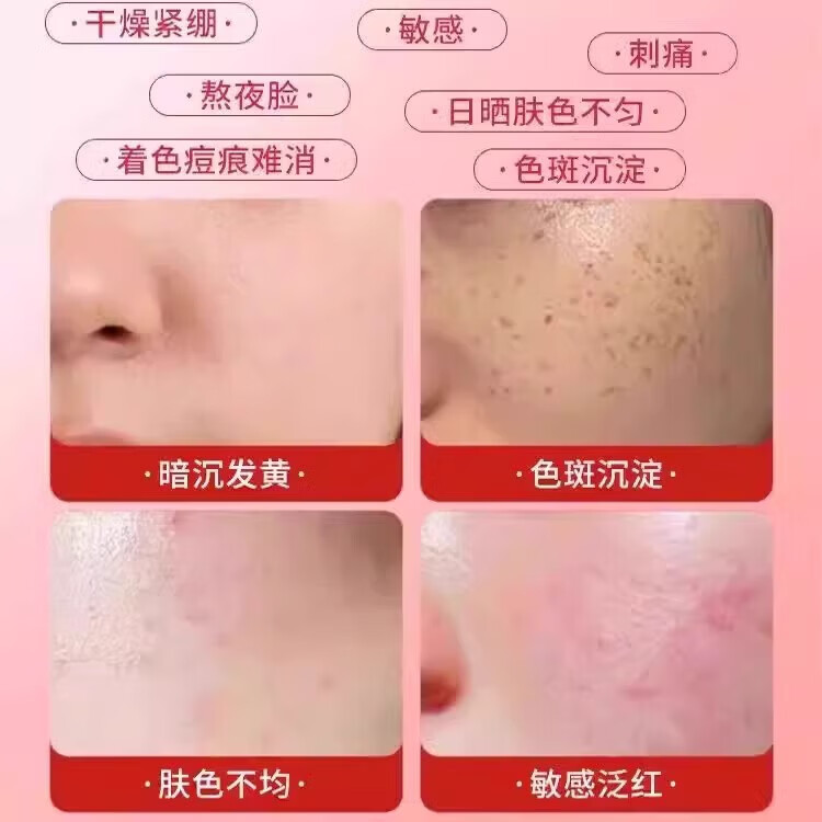 烟酰胺凝胶和熊果苷乳膏男女士保湿滋润提亮肤色肌肤暗沉 【6支巩固装】烟酰胺+熊果苷