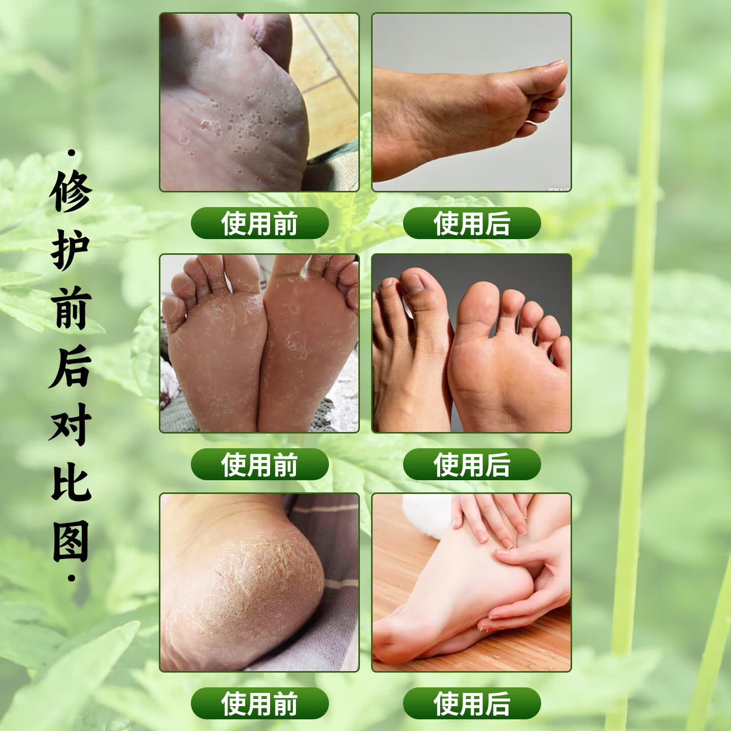 富晴脚气止痒灵脚后跟干裂修复霜防裂足脱皮强效滋润门店同款