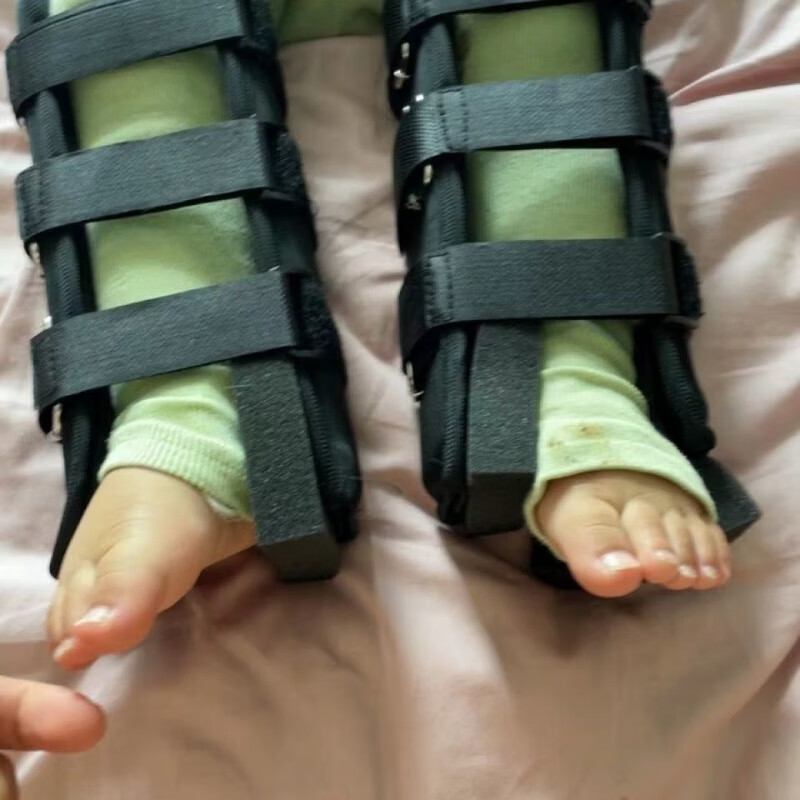 宝宝儿童腿型矫正器罗圈腿绑腿直腿ox腿部神器成人小腿外翻纠正器 xxs