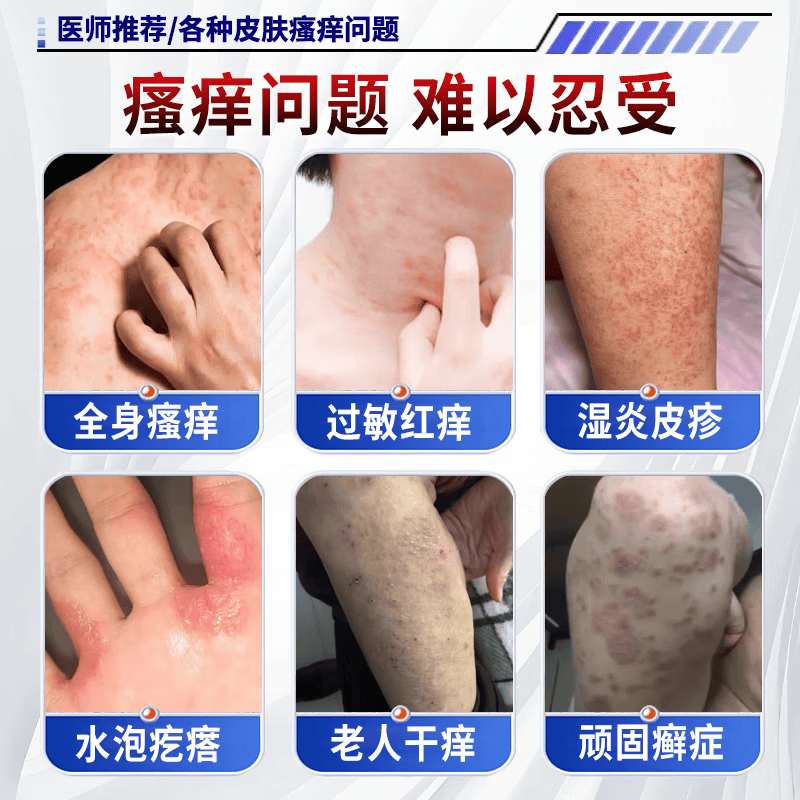 狼毒蛇床子祛痒膏止痒膏抑菌皮肤瘙痒皮湿炎疹真菌感染止痒药膏 特效买2送1【一抹止痒】