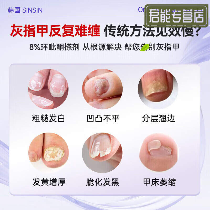 MRYU环吡吡酮搽剂灰指甲专用特新效药胺乳膏剂指甲增厚发黄变厚真 一瓶见效装 【官方直售京质保障】