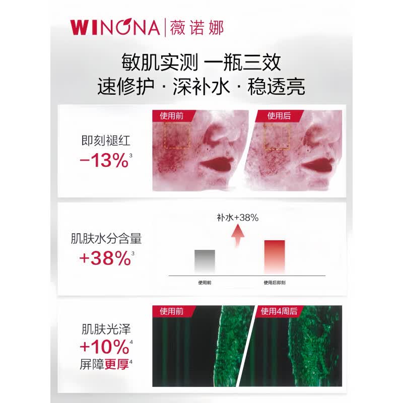 薇诺娜舒敏保湿特护精华水120ml舒缓敏感肌补水爽肤水官方女 120ml 舒敏特护精华水120ml