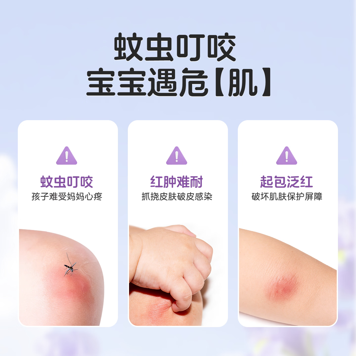 Akasugu爱舒屋紫草膏清凉舒缓儿童宝宝蚊虫叮咬外出便携多效舒润 【多买更实惠】多效舒润紫草膏3支装