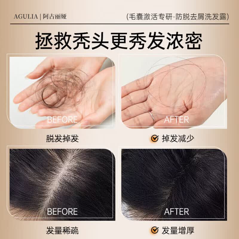阿古丽娅耐菲娜防脱洗发水养发锁发生姜洗发水防脱固发去屑止痒控油蓬松 5瓶装 买三赠二【囤货装】 【官方直售 京质保障】