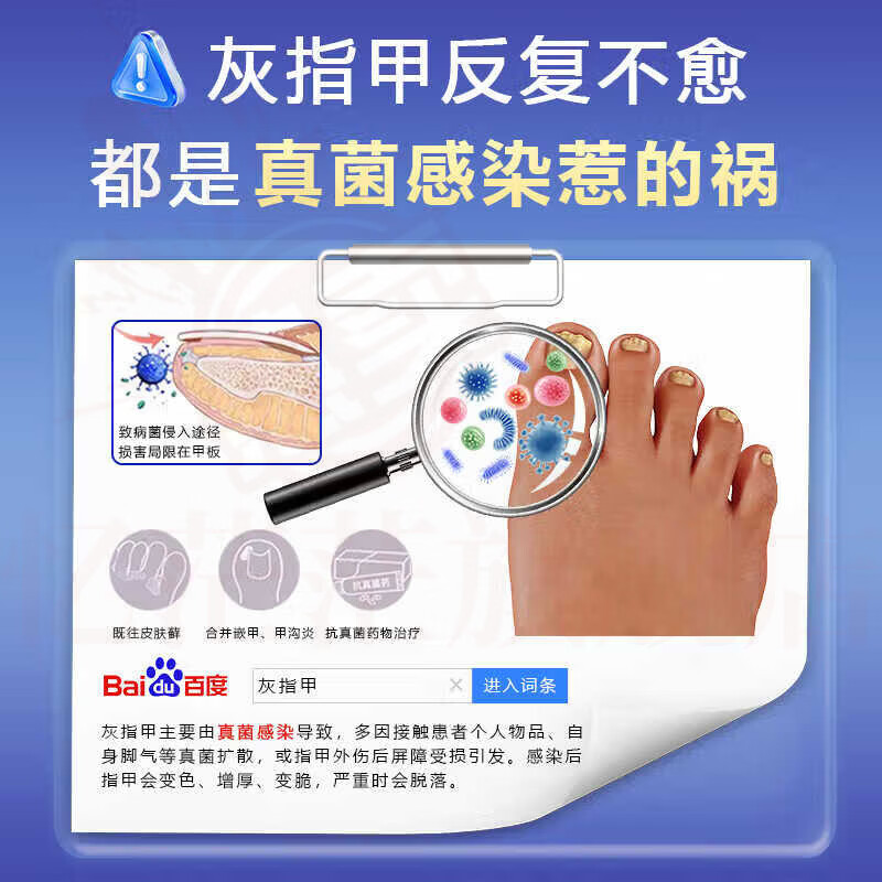 御灵花灰指甲发黄增厚软甲坏甲空甲萎缩甲变色男女适用专用护理膏 1支装【体验发正装】 【官方直售 京质保障】 御灵花灰指甲发黄增厚软甲坏甲空甲萎缩甲变色男女适用专用护理膏 1支装【体验发正装】 【官方直售 京质保障】