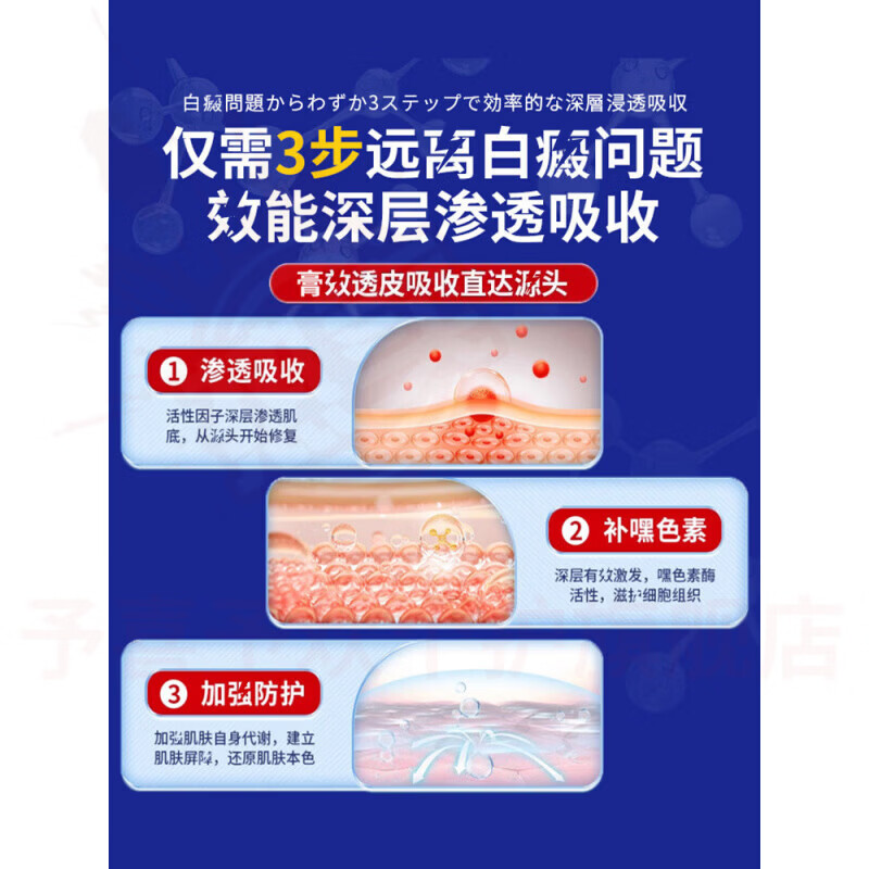 鹿角卉乳膏花斑白斑汗斑白肤色不均护理膏身体护肤外用膏 5瓶【巩固装】 官方自售