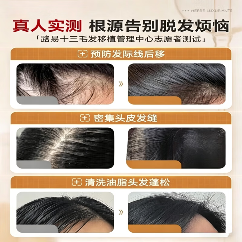 棵雨洗发水防脱固发控油蓬松去屑滋养头皮强韧发根止痒柔顺草本植 1支装【体验发正装】 【品质保障 谨防低价假货】