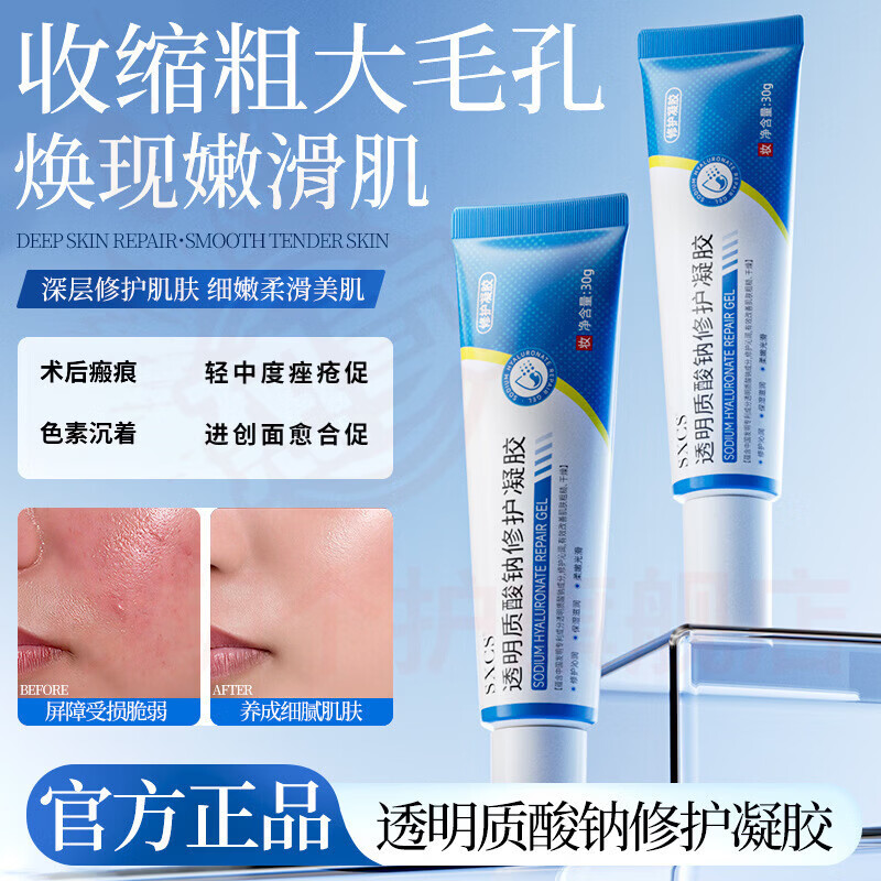 熏姿颜奥传司修复凝胶修复皮肤过敏轻中度痤疮促进创面愈合男女适用 5支【巩固装】 官方自售