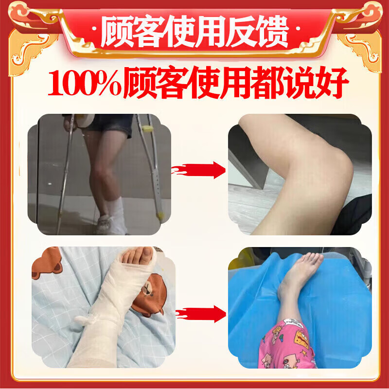 进口骨折骨裂恢复的药促进骨折愈合快速接骨跌打损伤消肿止痛有药 一瓶【体验装】