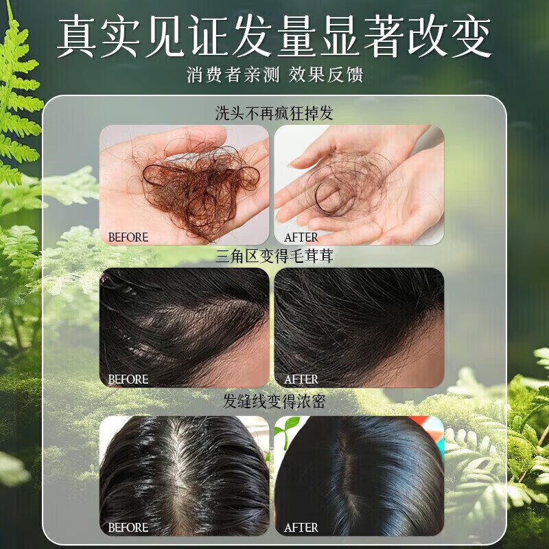 UAOE【1洗头发暴涨】纯植物侧柏叶洗发皂何首乌人参中药手工防脱育发 买2送1【针对中重度脱发】长出茂密发76%客户选择-