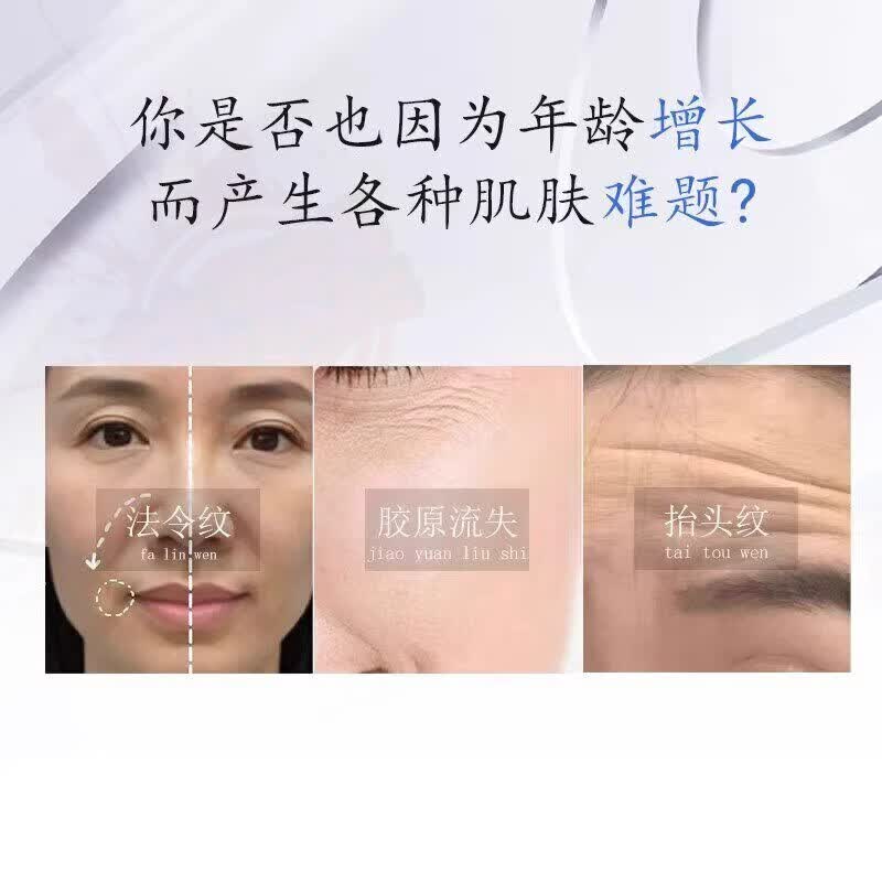 舒活宜护理膜修护眼纹肥胖纹妊娠纹淡化生长纹法令纹颈纹不刺激 5盒【巩固装】 品牌直售