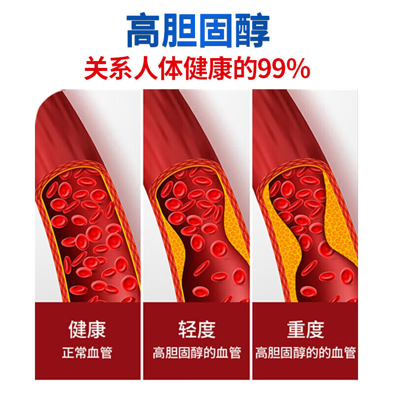 金凯撒(OMEGOR)红鱼油红凯撒深海鱼油omega-3红曲米软胶囊辅酶epa 金凯撒红鱼油omega-3软胶囊 90粒*1盒