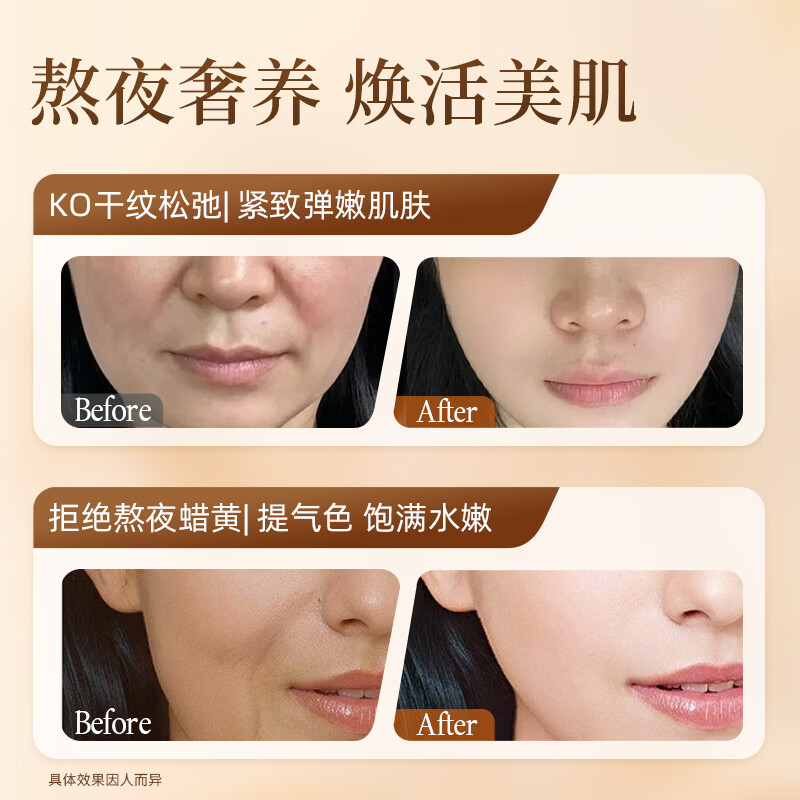 NCCU老牌国货黄芪抗皱弹润面霜改善皮肤暗黄保湿补水滋润 50g