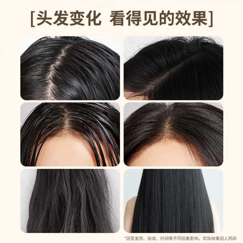 芃芃草云诗妍防脱洗发水官方旗舰生姜固发育发密发增发防断发去屑控油 5瓶装【超值装】买三赠二 98%的顾客选择 【官方旗舰 京质保障】