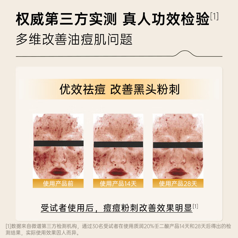 质润壬二酸15%凝胶祛痘去黑头祛痘膏凝胶闭口粉刺淡化痘印壬二酸乳膏 【升级主推】壬二酸凝胶救急祛痘不留印 25g