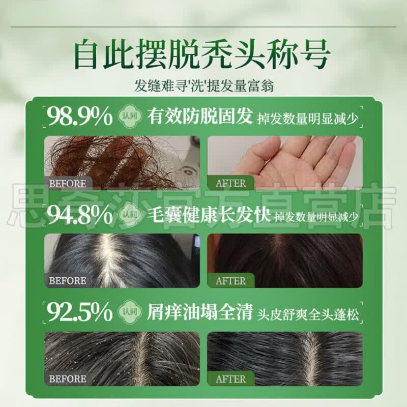 北柔(BEIROU)众康尚品头发滋养液七天防脱去屑止痒浓密增长强韧发丝官方正品 1瓶装【体验发正装】 【官方直售 京质保障】