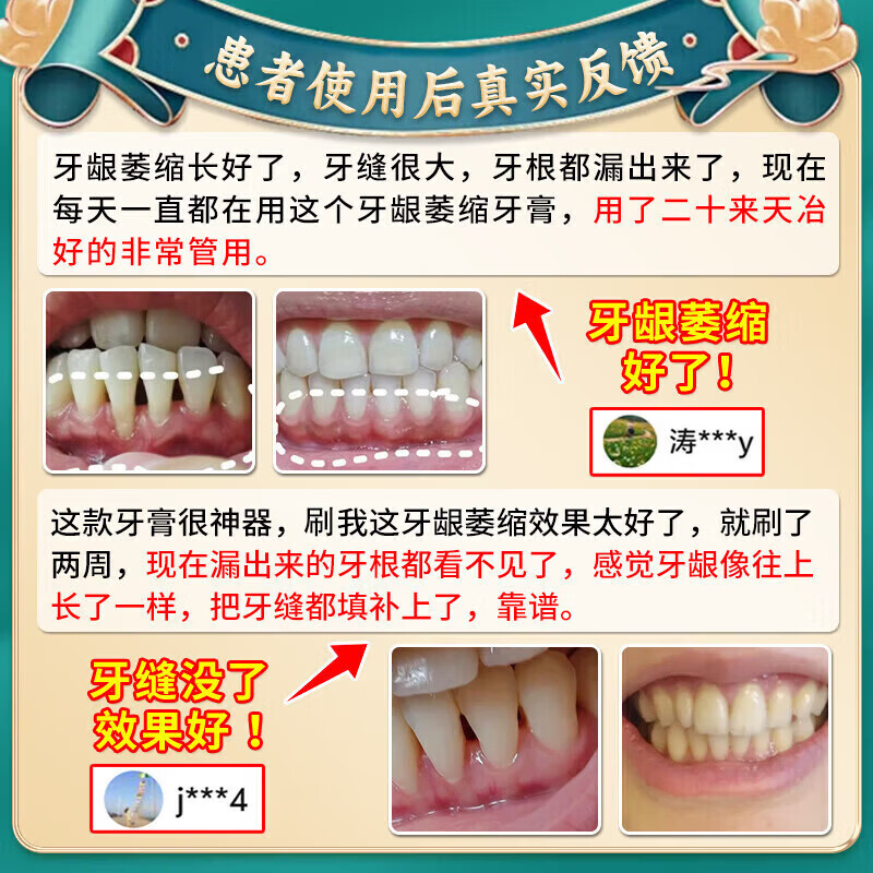 李时珍牙膏护龈固齿牙龈萎缩修复再生牙根外露脱敏膏牙齿松动专用牙周炎 买3送2【100%必裉除】 牙膏修复再生牙根外露金榜第一