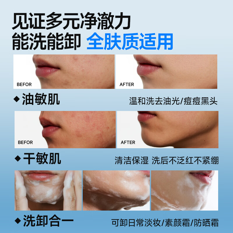 左颜右色洗面奶男士微酸控油祛痘去黑头收缩毛孔水杨酸氨基酸温和洗面奶 【慕斯型】微酸洗面奶150g【油/痘/黑头】