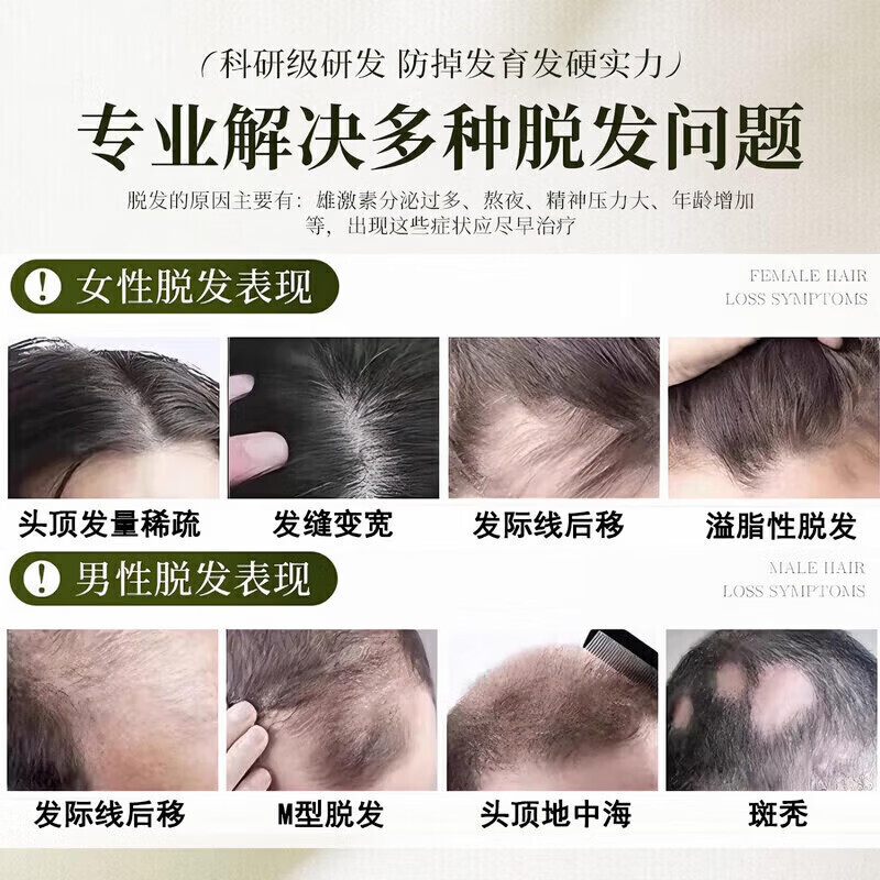 UAOE【1洗头发暴涨】纯植物侧柏叶洗发皂何首乌人参中药手工防脱育发 买2送1【针对中重度脱发】长出茂密发76%客户选择-